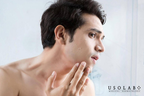 Làn da của nam giới cũng cần được chăm sóc không kém so với làn da của các chị em