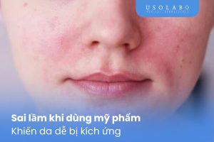 Sai lầm khi dùng mỹ phẩm khiến da dễ bị kích ứng