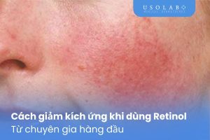 Cách giảm kích ứng khi dùng Retinol