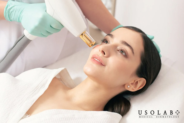 Những câu hỏi thường gặp sau khi bắn laser
