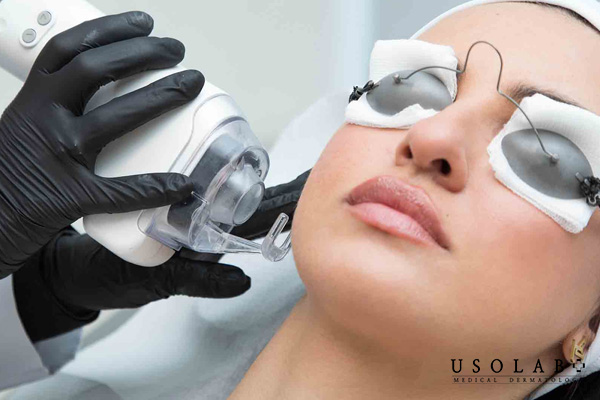 Câu hỏi thường gặp về kem dưỡng sau laser CO2 fractional