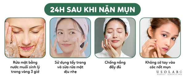 mới nặn mụn xong nên làm gì