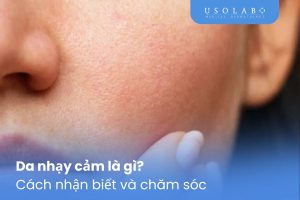 Da nhạy cảm là gì