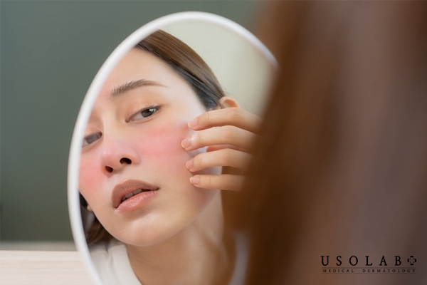 Dùng tần suất thấp trước