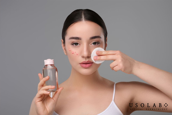 Hướng dẫn cách tẩy trang đúng cho da dầu mụn