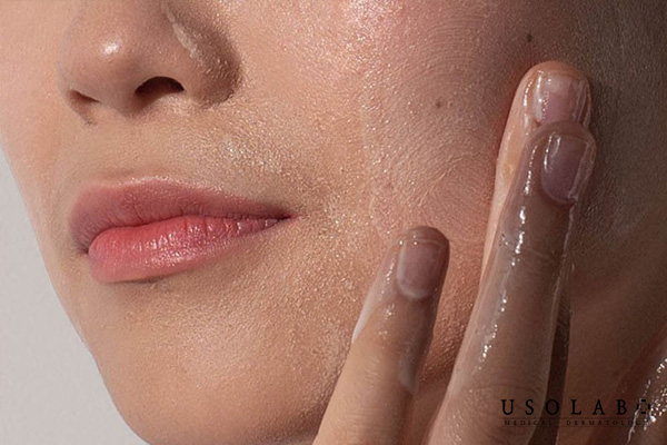 Kem dưỡng sau laser CO2 fractional