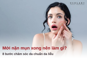 mới nặn mụn xong nên làm gì