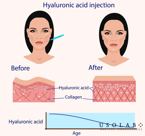 serum HA 2% cho da nhạy cảm
