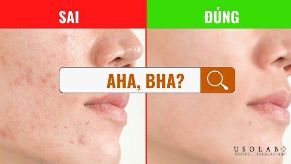 so sánh AHA và BHA cho da dầu mụn