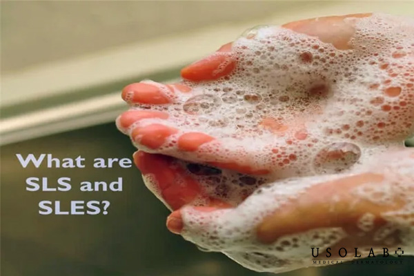Sulfate (SLS, SLES)