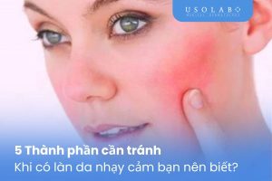 Thành phần cần tránh khi có làn da nhạy cảm
