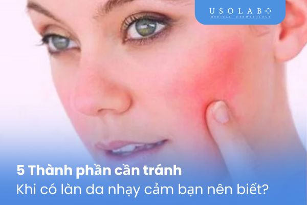 Thành phần cần tránh khi có làn da nhạy cảm