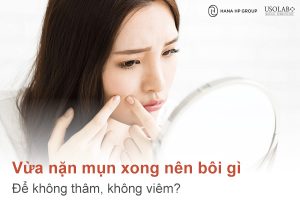 vừa nặn mụn xong nên bôi gì