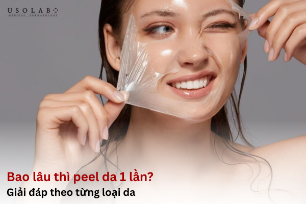 Bao lâu thì peel da 1 lần