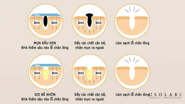cách dùng BHA