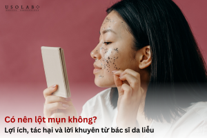 có nên lột mụn không