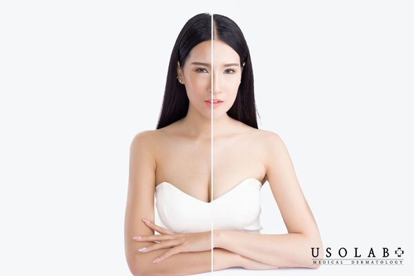 Hiểu đúng về “da trắng”