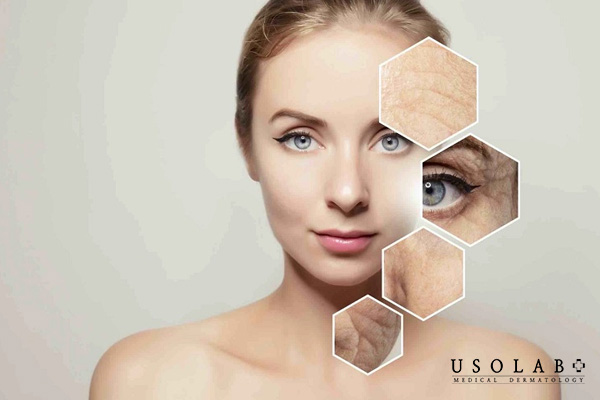 Quy trình phục hồi da sau khi bị bỏng do peel