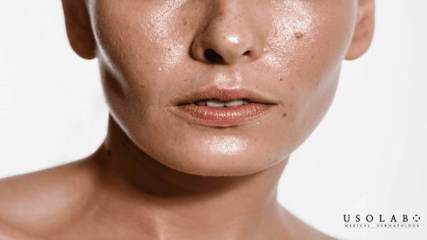 Serum kiềm dầu