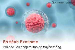 So sánh Exosome