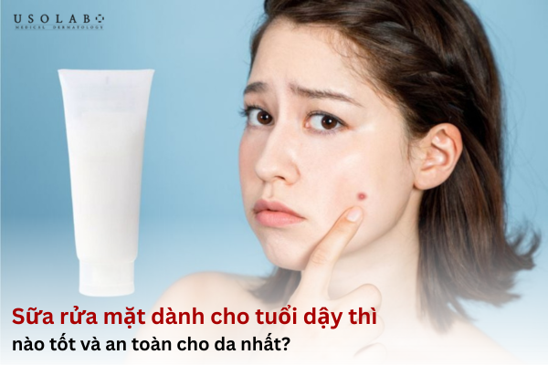 Sữa rửa mặt dành cho tuổi dậy thì