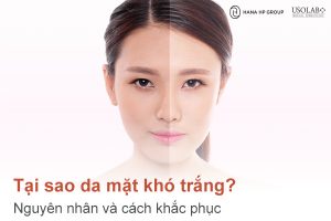 Tại sao da mặt khó trắng? Nguyên nhân và cách khắc phục