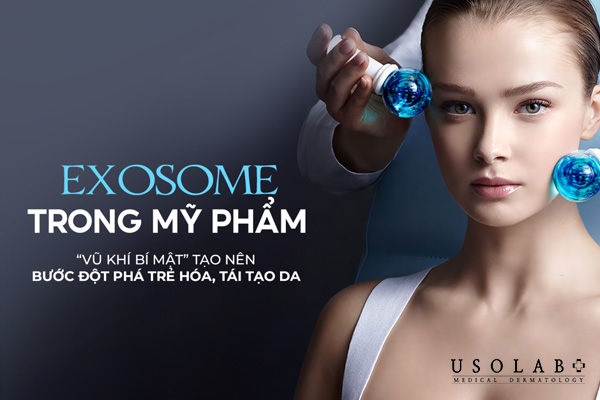 Ưu điểm của Exosome so với phương pháp cũ.