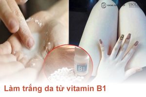 Bật mí 4 công thức làm trắng da từ vitamin B1 hiệu quả ngay tại nhà