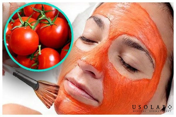 Chỉ nên áp dụng 1–2 lần/tuần để da có thời gian tái tạo