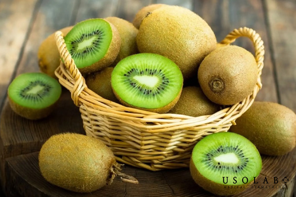 Kiwi là sự kết hợp hoàn hảo của Vitamin C và E