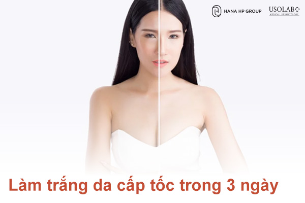 Cách làm trắng da cấp tốc trong 3 ngày với 5 công thức được ưa chuộng