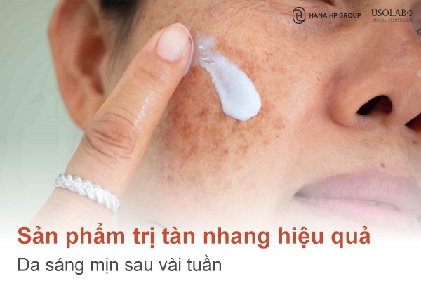 Top 4 sản phẩm trị tàn nhang hiệu quả – Da sáng mịn sau vài tuần