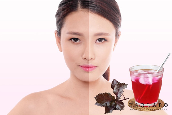 Uống nước lá tía tô giúp trắng da từ bên trong