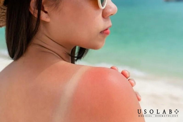 Tác động của clo và hóa chất trong hồ bơi
