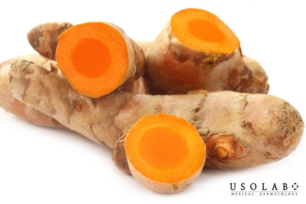 Trong nghệ chứa hoạt chất curcumin – một chất chống oxy hóa mạnh mẽ