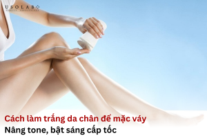 cách làm trắng da chân để mặc váy