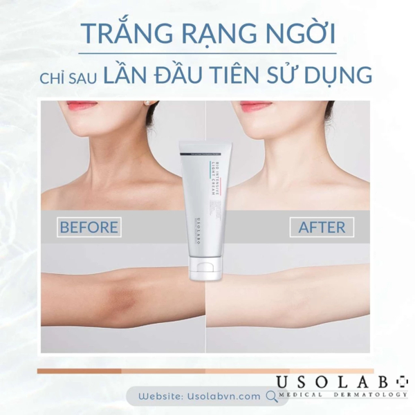 Light Cream của Usolab cách làm trắng da chân để mặc váy