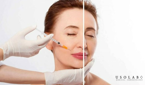 Không phải ai cũng phù hợp với phương pháp cấy trắng collagen Không phải ai cũng phù hợp với phương pháp cấy trắng collagen