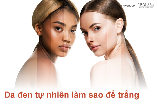 Da đen tự nhiên làm sao để trắng cách chăm sóc da đúng cách