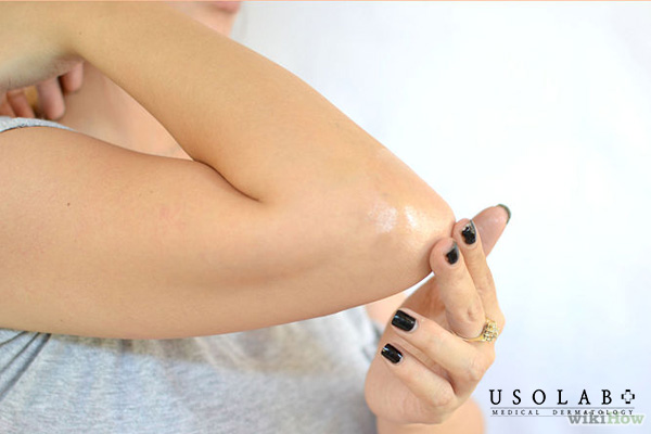 Kem dưỡng trắng chứa vitamin C, niacinamide.