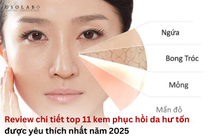 kem phục hồi da hư tổn