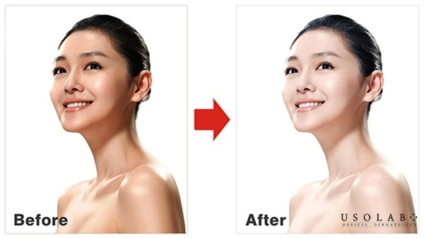 Vì sao bạn cần tìm cách làm trắng da mặt nhanh trong 1 tuần Vì sao bạn cần tìm cách làm trắng da mặt nhanh trong 1 tuần