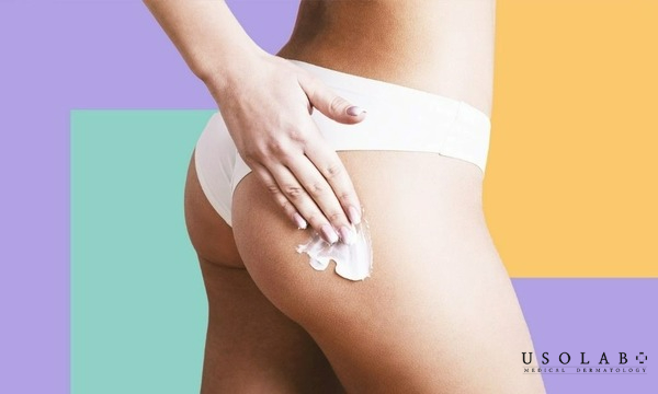 Thoa kem hoặc Lotion dưỡng ẩm để da không bị khô sần