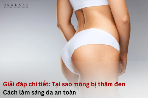 tại sao mông bị thâm đen