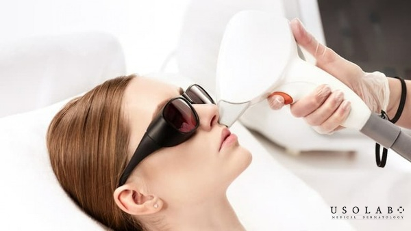Triệt lông tại các cơ sở làm đẹp uy tín, chất lượng