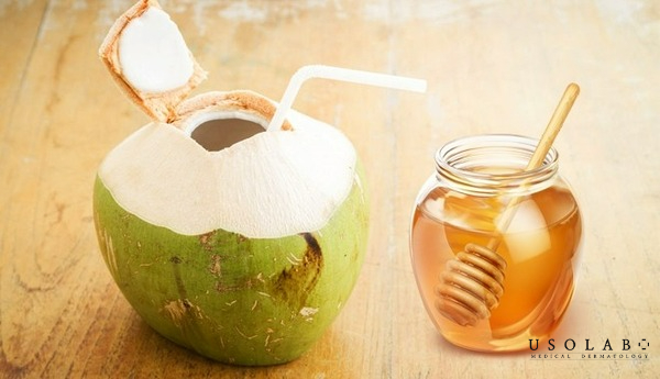 Nước dừa và mật ong: làm dịu, kháng khuẩn, phục hồi da sau cháy nắng Nước dừa và mật ong: làm dịu, kháng khuẩn, phục hồi da sau cháy nắng