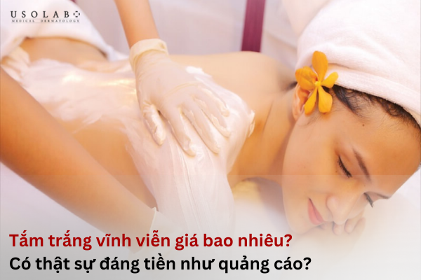 tắm trắng vĩnh viễn giá bao nhiêu