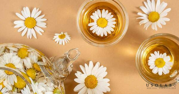 Hoa cúc la mã – giảm sưng đỏ, phục hồi làn da tổn thương