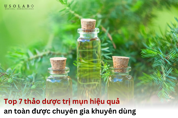 thảo dược trị mụn