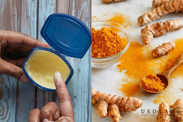 Vaseline và tinh bột nghệ